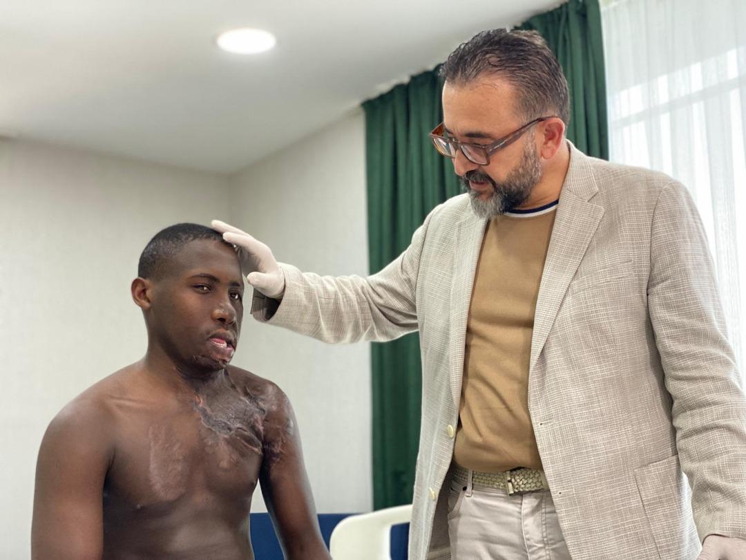 Acı verici bekleme: Yüz ve boyunda ağır yanıklar vardı! Papaz Ugandali 10 yıl sonra Türkiye'de tedavi edildi ... 4