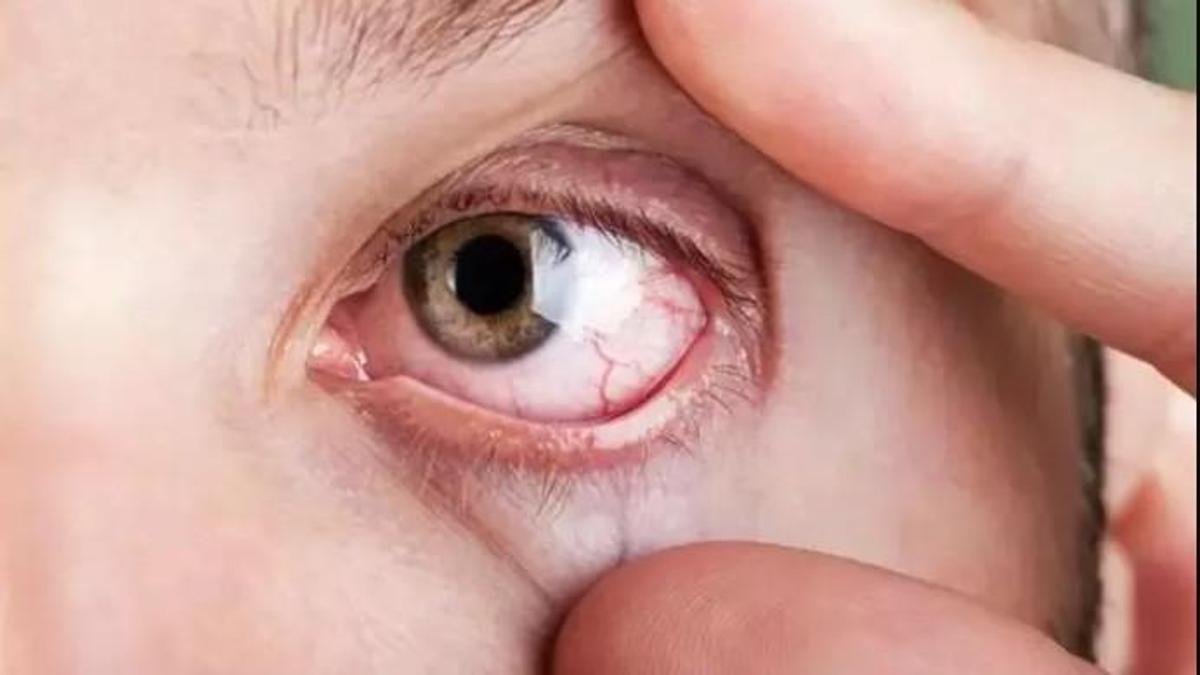 40'tan fazla olan herkes, gözlerin kan basıncına karşı düzenli bir sınav olmalıdır